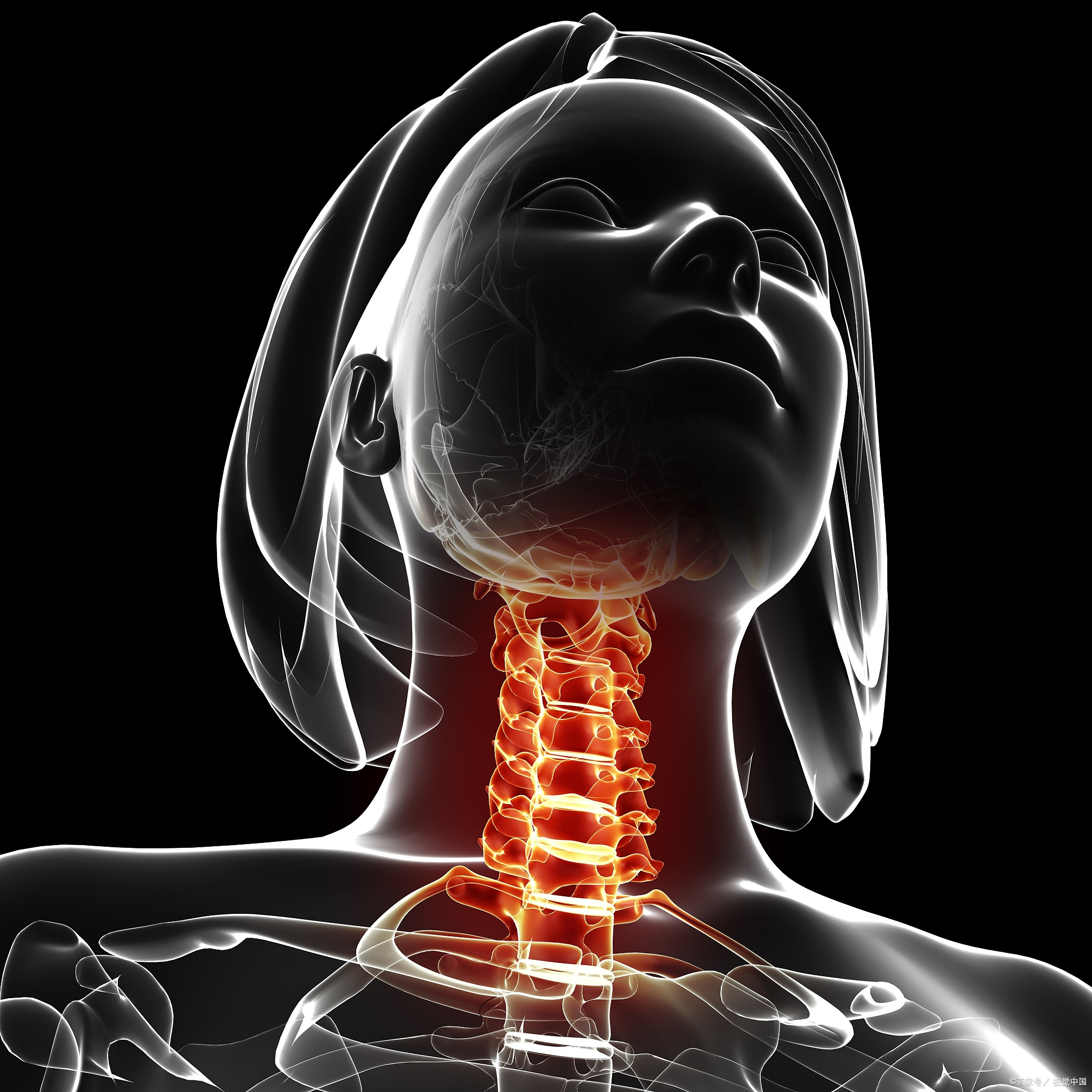 大夫，我得了颈肩综合征，怎么办？