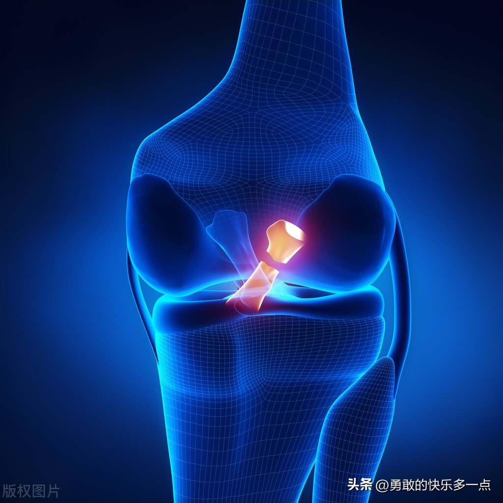 膝关节疼痛伴随着足关节痛,膝关节活动不痛走路痛是什么原因