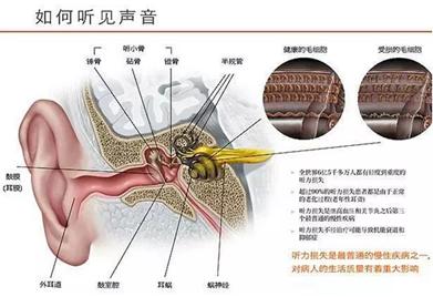 突发性耳聋的原因和症状,突发性耳聋的表现及治疗原则是