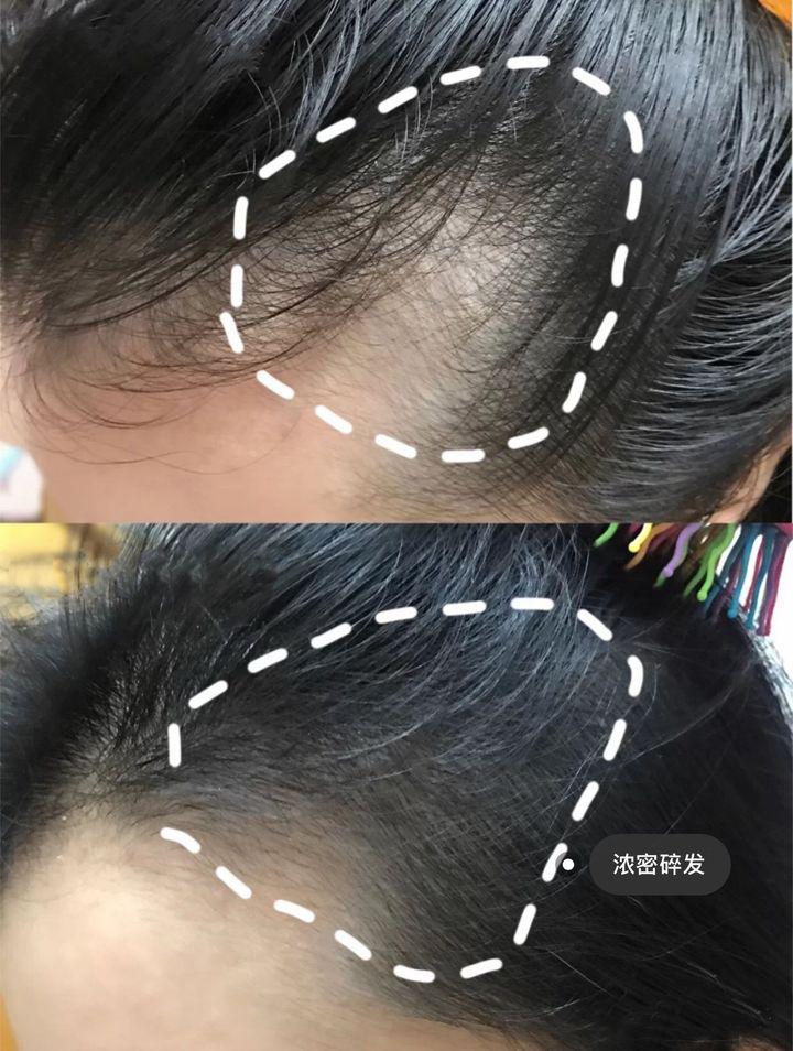 2023防脱育发洗发水大测评,2022洗发水排名防脱洗发水