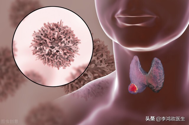 常见癌症的体检筛查方法,体检癌症筛查需要多少费用