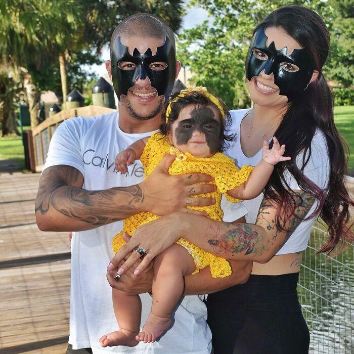 美国小女孩脸带“蝙蝠侠”黑印,治疗两年经过终于恢复肉色!