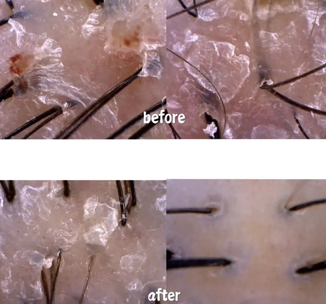 发型师教你如何在家打理头发,搞头发教程