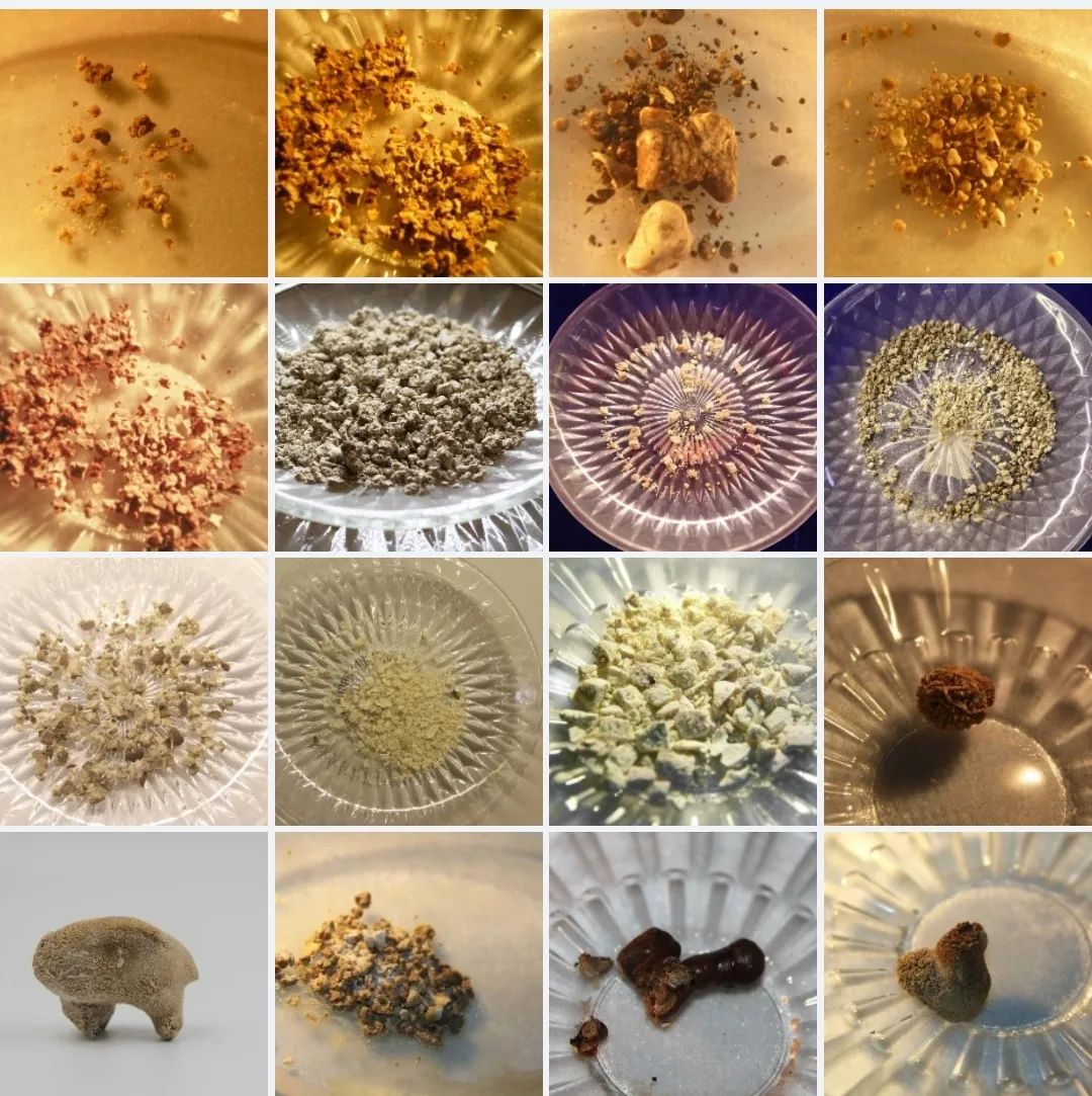 输尿管结石体外碎石多久能排出来,为什么做了体外碎石不尿血