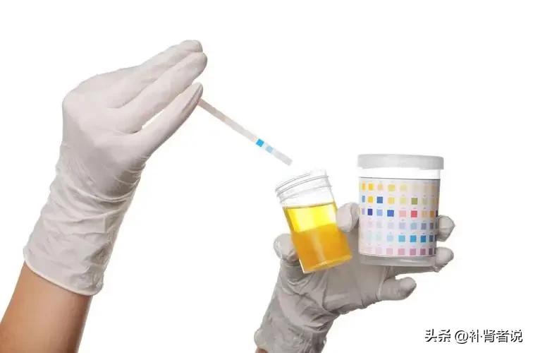 尿隐血是怎么回事1+要紧吗,尿隐血是怎么回事知乎