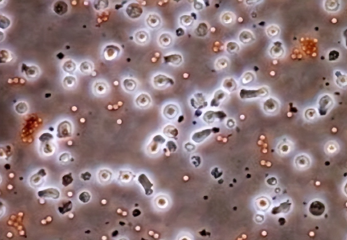 蒲公英会降血糖吗,蒲公英车前草的抗癌功效与作用