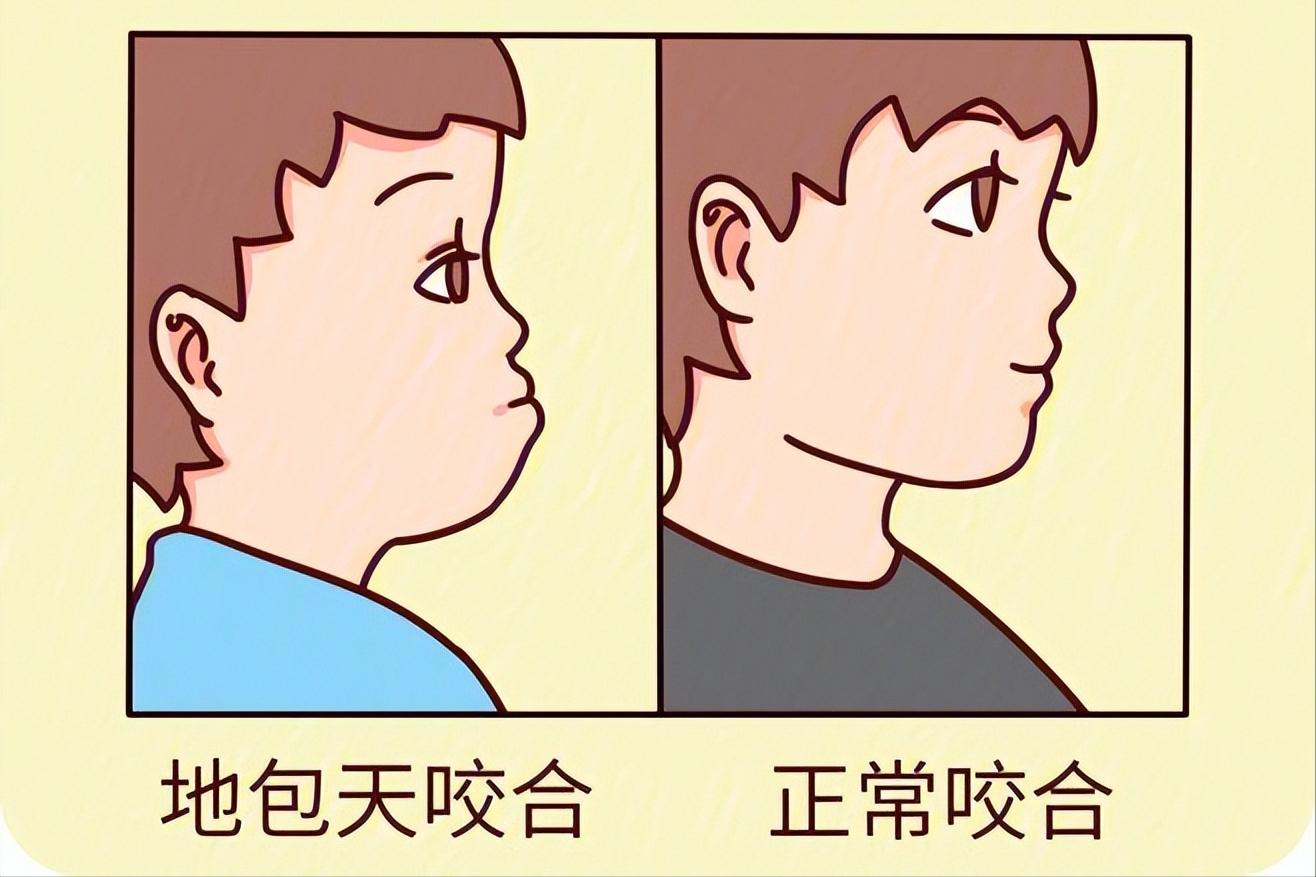 孩子有双排牙,小孩长双排牙前面的乳牙很松没掉