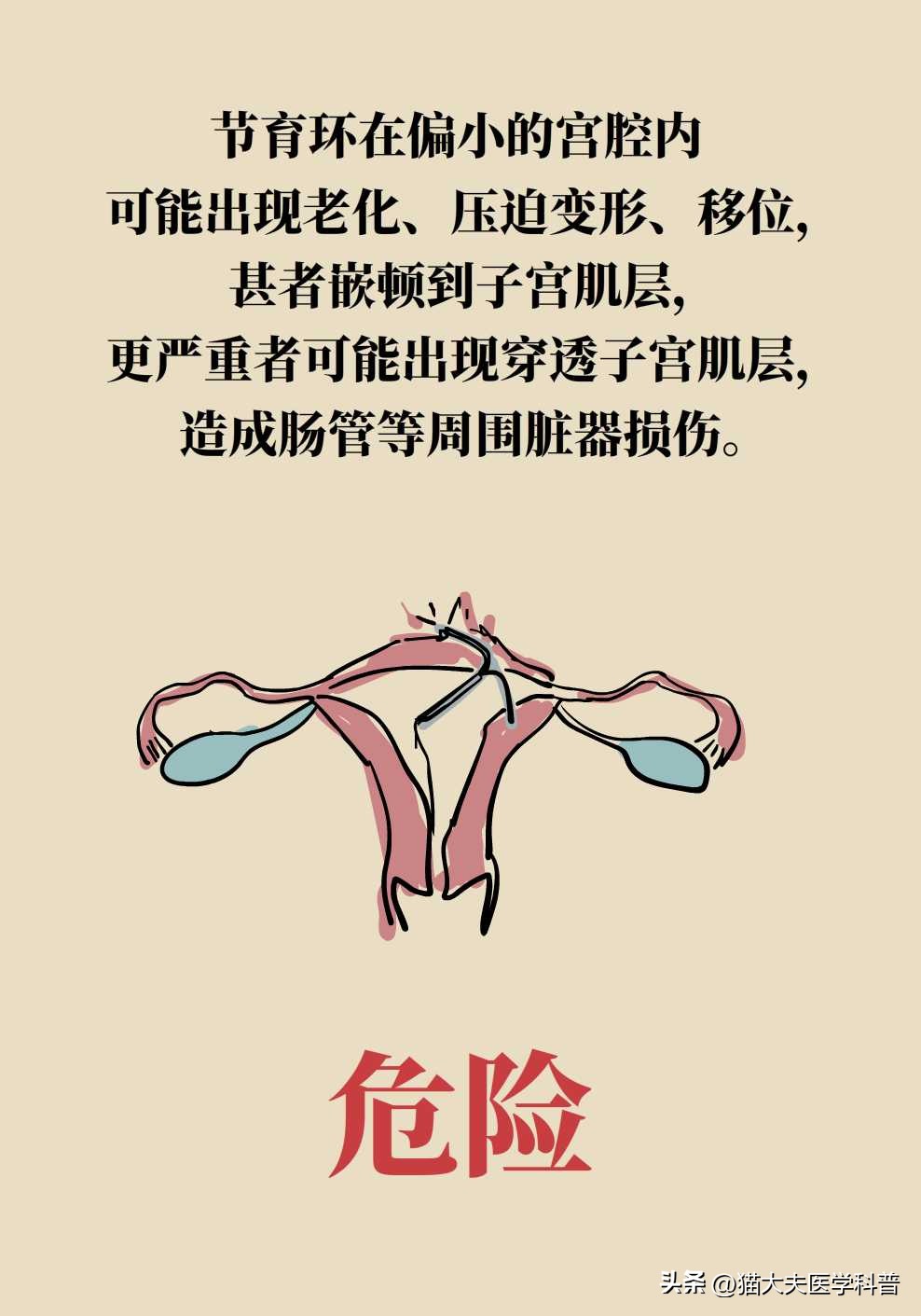 绝经后取环还会怀孕不,绝经后取环还能怀孕吗