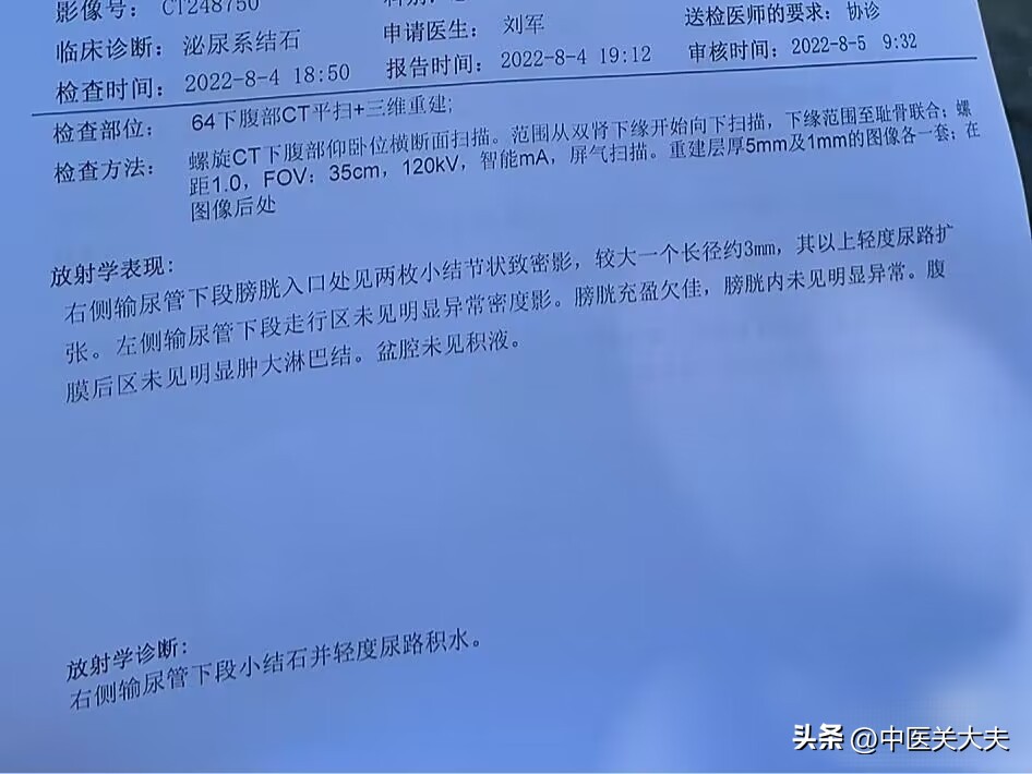 输尿管结石下段2mmx3mm可以排石吗,输尿管结石23毫米