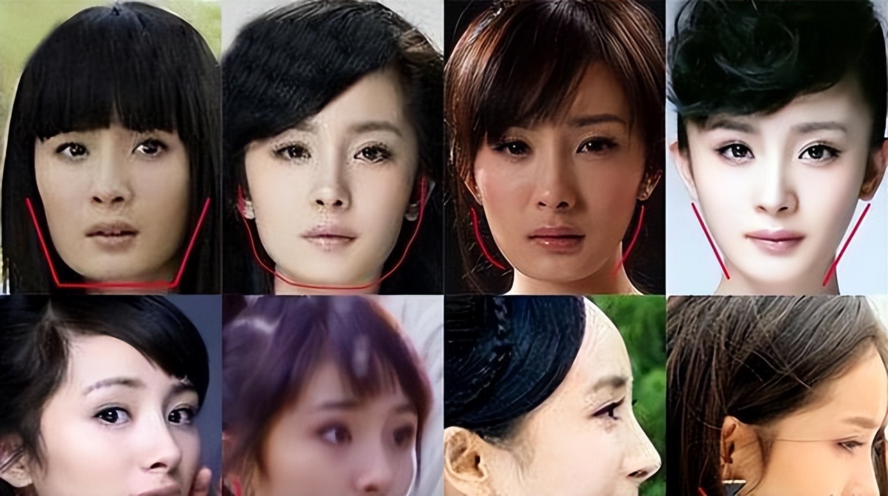 整容脸老了以后会怎么样,整容脸会一直维持一个样子吗