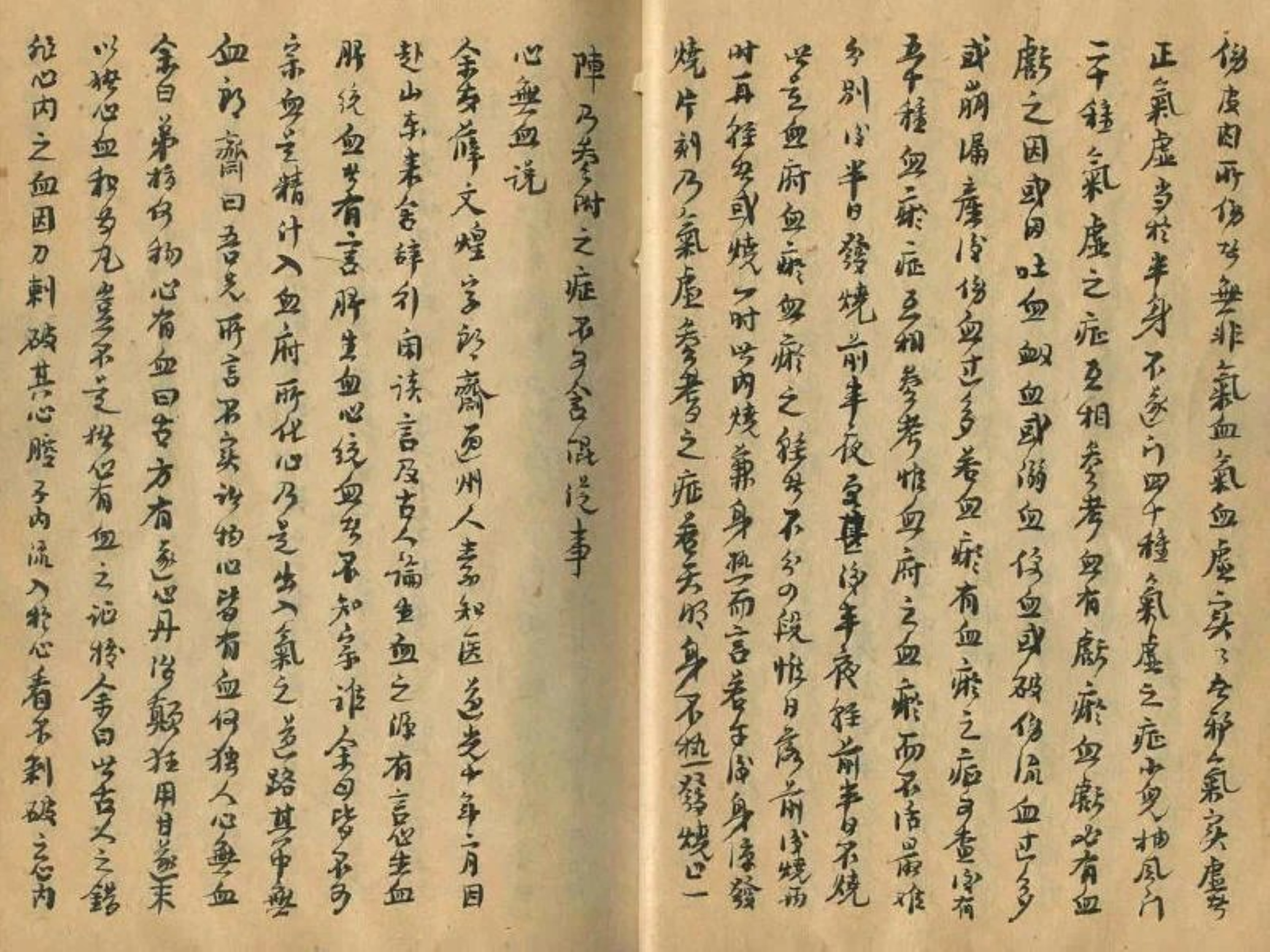 民间中医验方秘方手抄本汇集,中医治半身不遂最好的方法