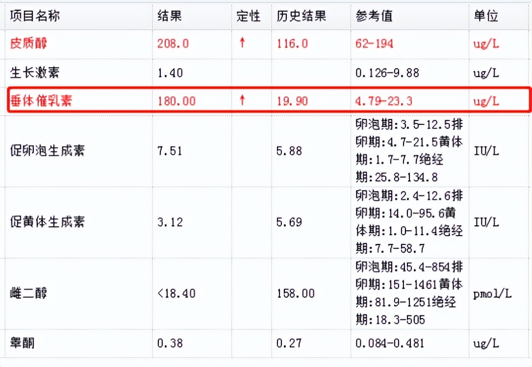 30岁就“停经”正常吗？警惕垂体瘤