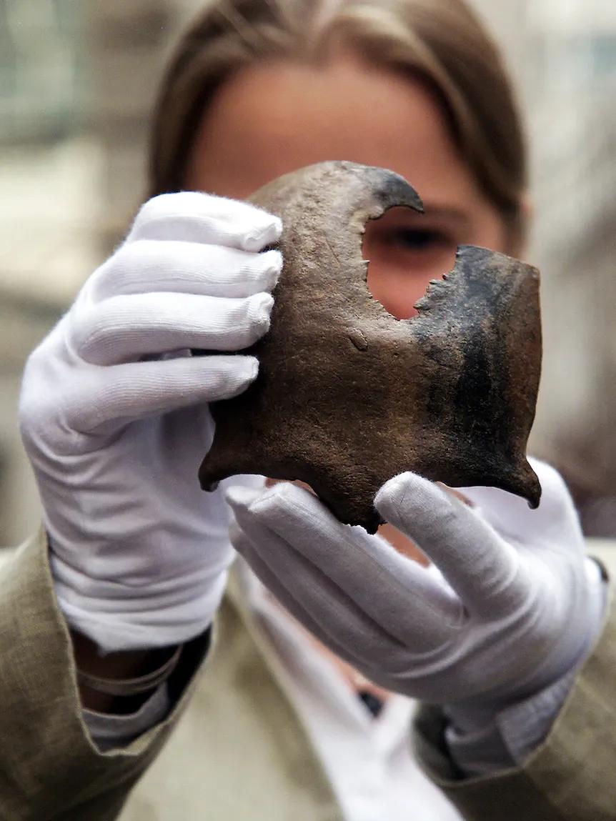 人类医疗技术发展史,人类医疗史上最悲剧的手术