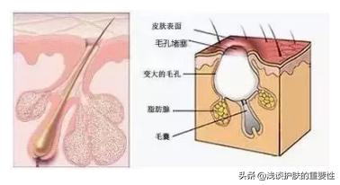 收缩毛孔粗大的方法真的有效,毛孔大怎么改善真的可以收缩毛孔