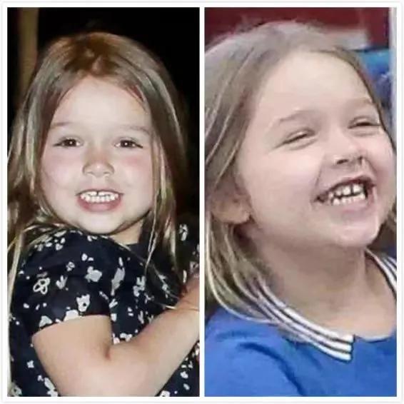 这五个坏习惯真的会让孩子变丑,这些小习惯让你变丑