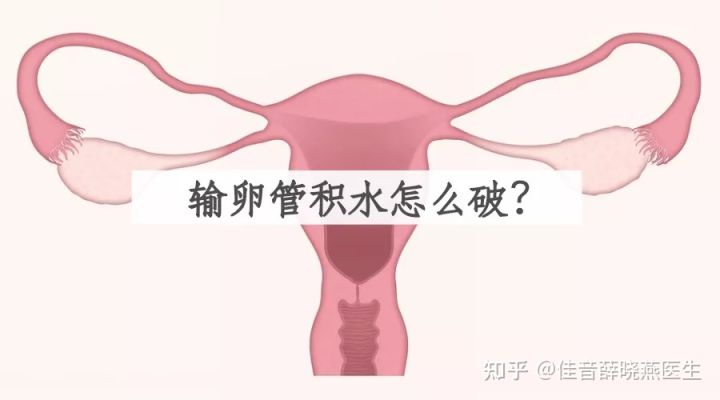 输卵管积水怎么治疗最佳方法,输卵管积水怎么治疗最好