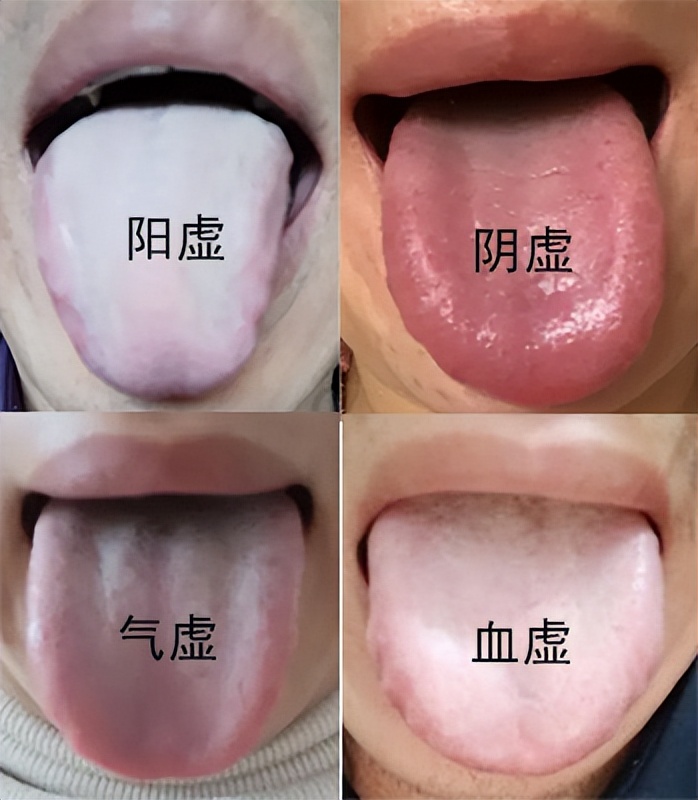 阳虚气虚血虚体质怎么调理吃啥药,气虚血虚阴虚阳虚的辨证