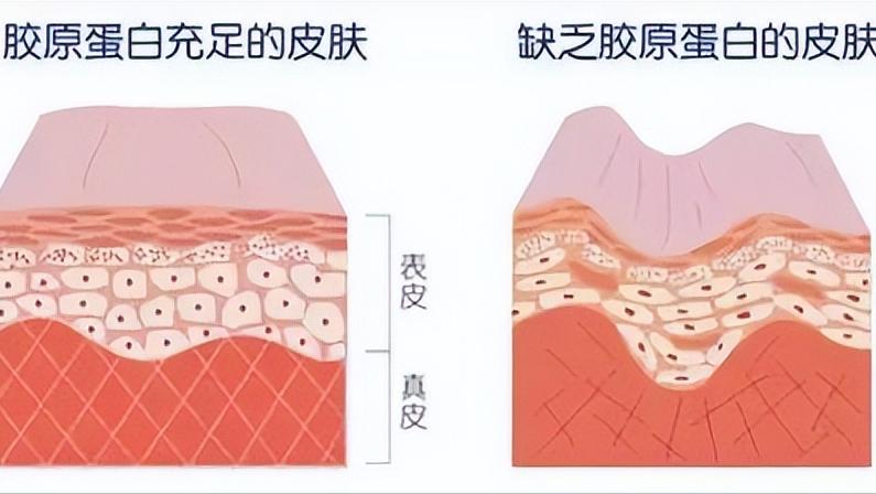 35岁男子坚持吃维生素C，后来怎么样了？医生：安全服用，牢记3点
