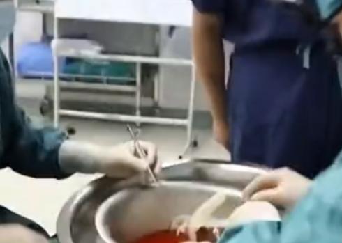 27岁新婚儿子割肝救父后续,河南18岁小伙割肝救父放弃从军