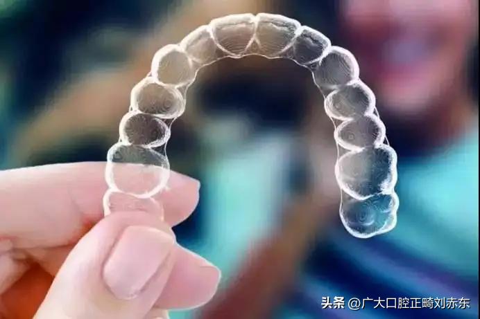 正畸需要多少钱,正畸的费用包含哪些