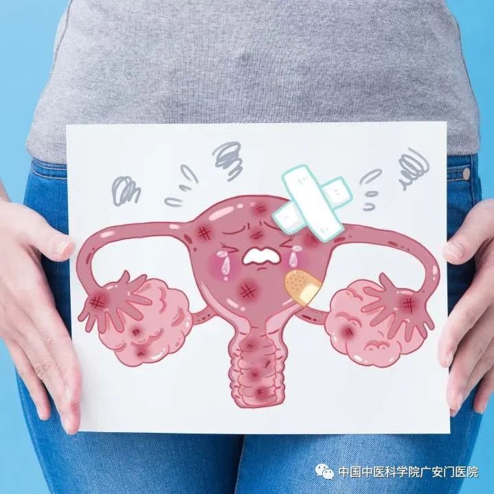 痛经不孕子宫内膜异位,子宫内膜异位症为什么会引起痛经