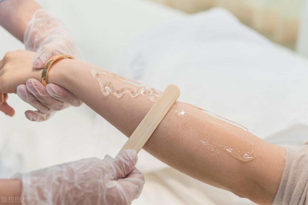 激光脱毛几次有效果,激光脱毛对白毛有作用吗