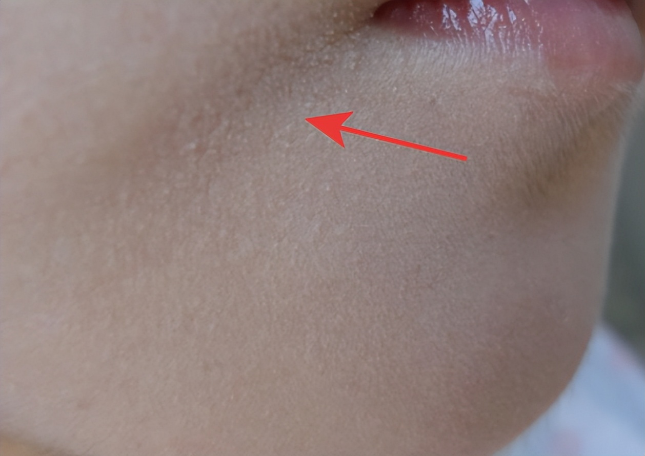 花漾缘面膜,花漾缘祛痘清洁面膜