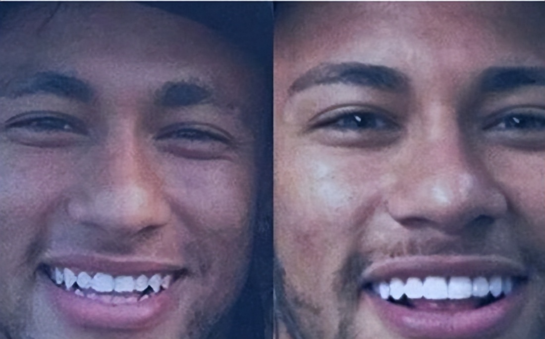 c罗内马尔厄齐尔,c罗内马尔贝尔照片