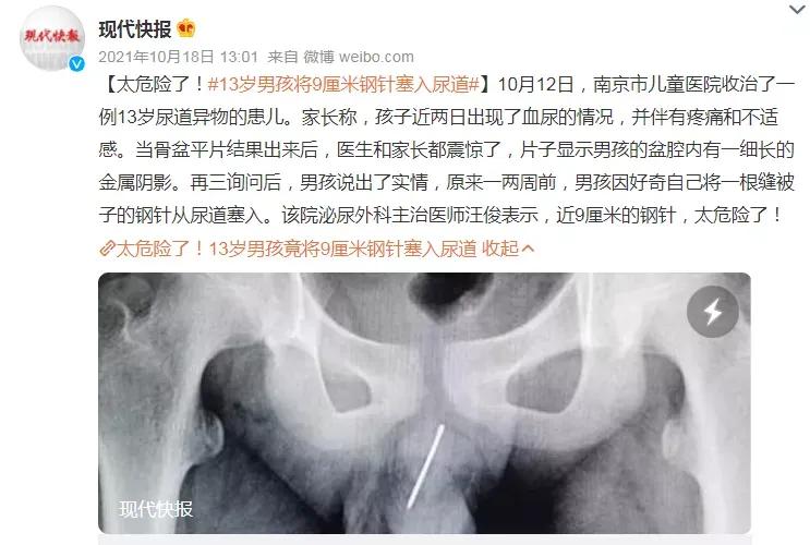 男孩往尿道塞近200颗“玩具球”，喜欢塞东西的熊孩子怎么回事