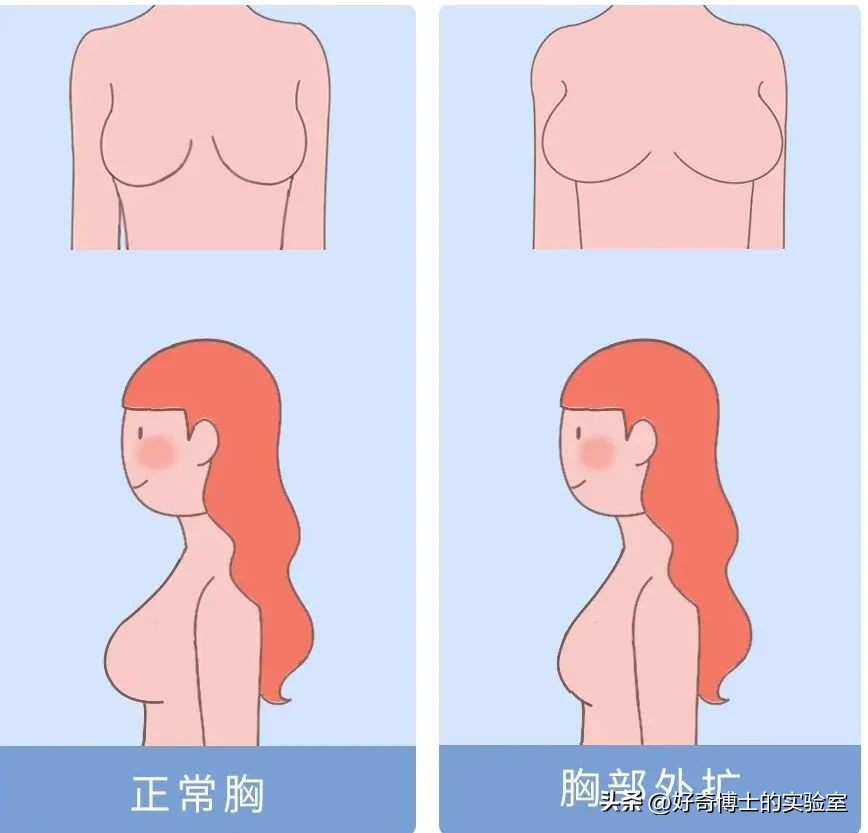 这些胸部小知识，建议男生都替女朋友看看