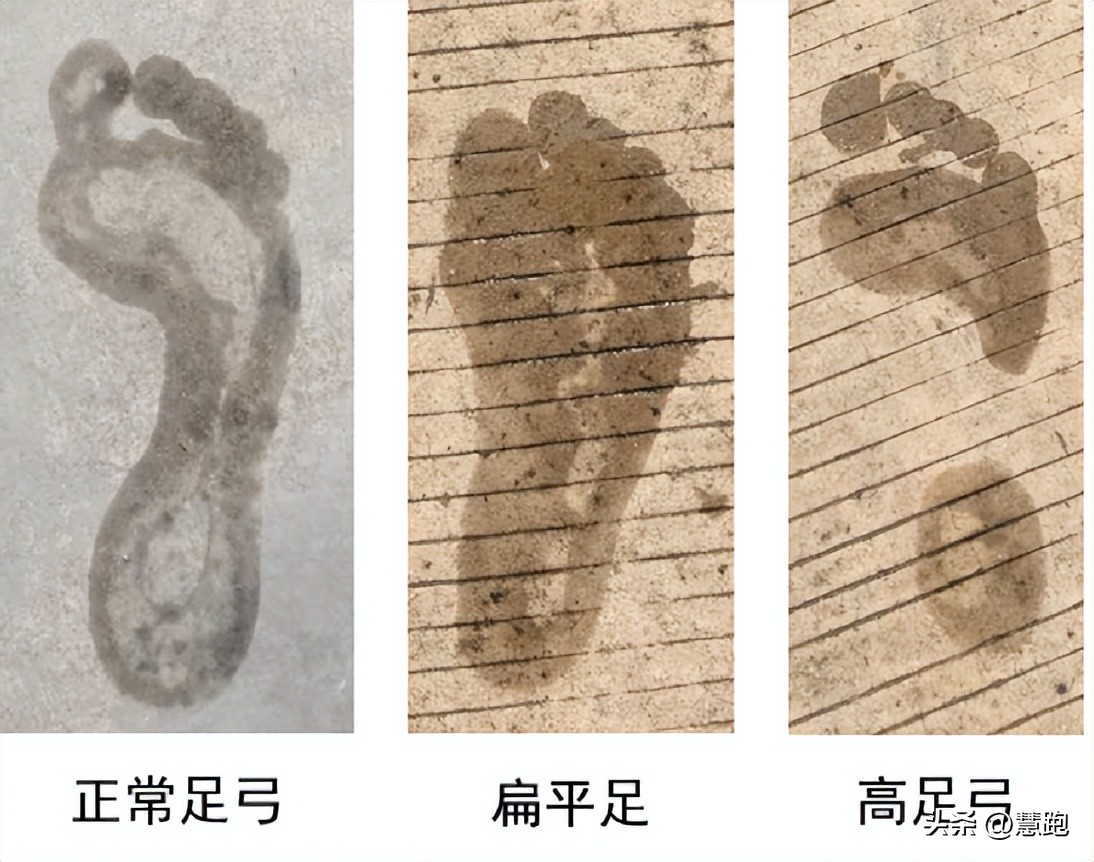 2022年稳定支撑跑鞋排行,2023稳定支撑跑鞋推荐