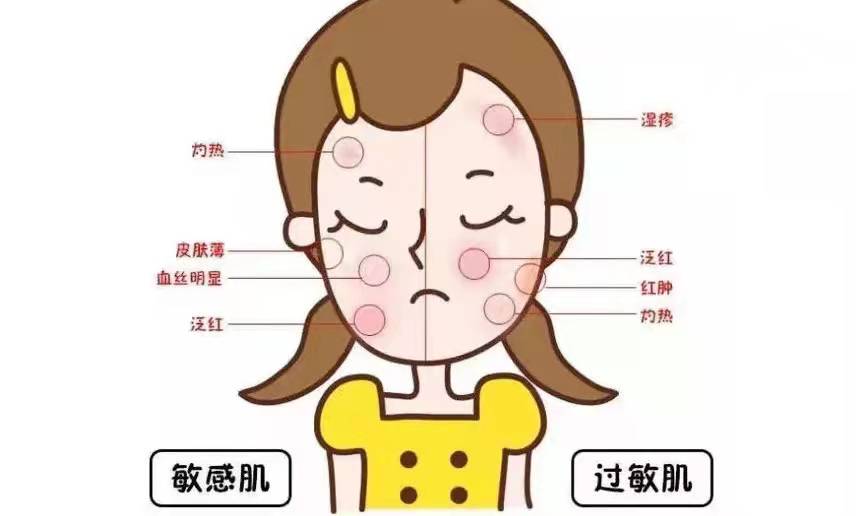 肤质自测小技巧,敏感肌如何测试自己是什么肤质