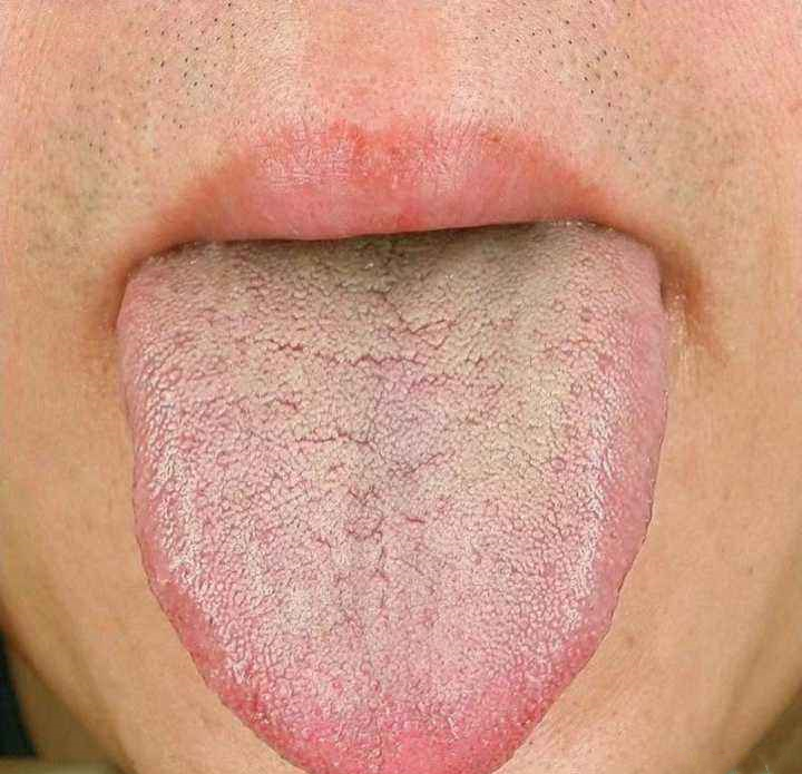 中医认为糖尿病的最好治疗方法,中医治疗糖尿病有几种治疗方案