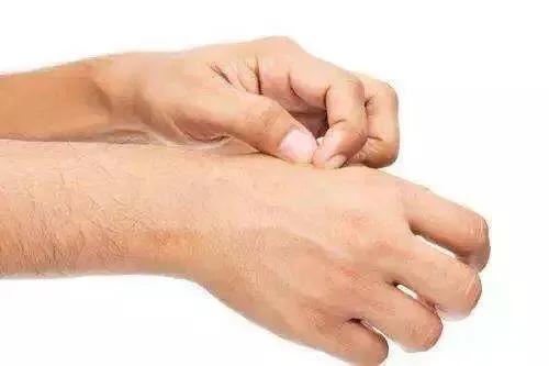 治疗湿疹的药膏,浅谈湿疹的治疗