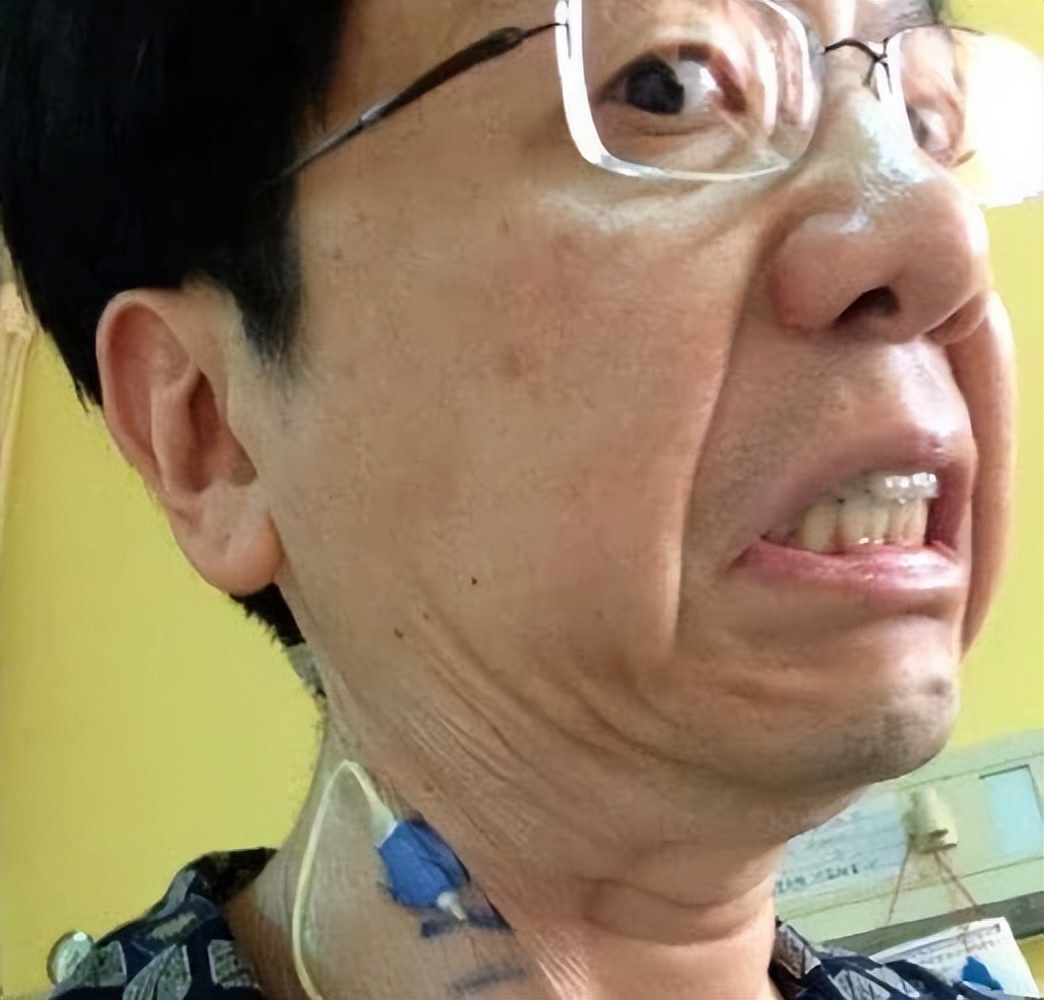 李开复抗癌成功过程,李开复抗癌从癌症到肿瘤消失9年