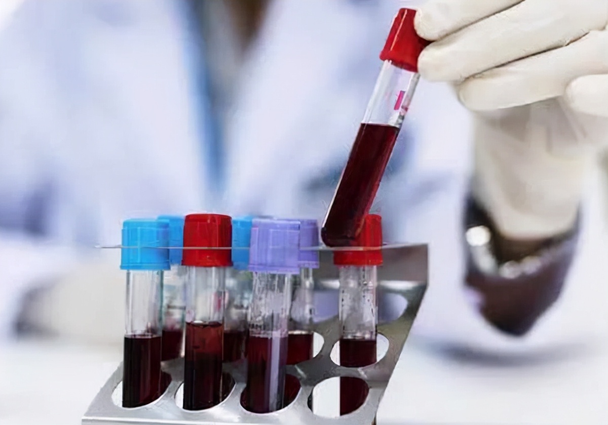 男子喝肌酸肾衰竭,男子喝酒尿毒症