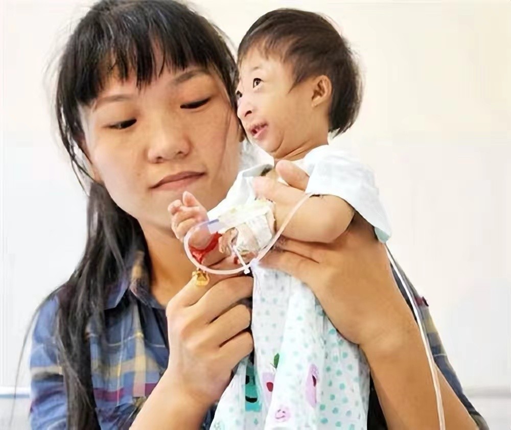 袖珍人梁小小刚刚出生的样子,袖珍女孩梁小小现在长大的样子