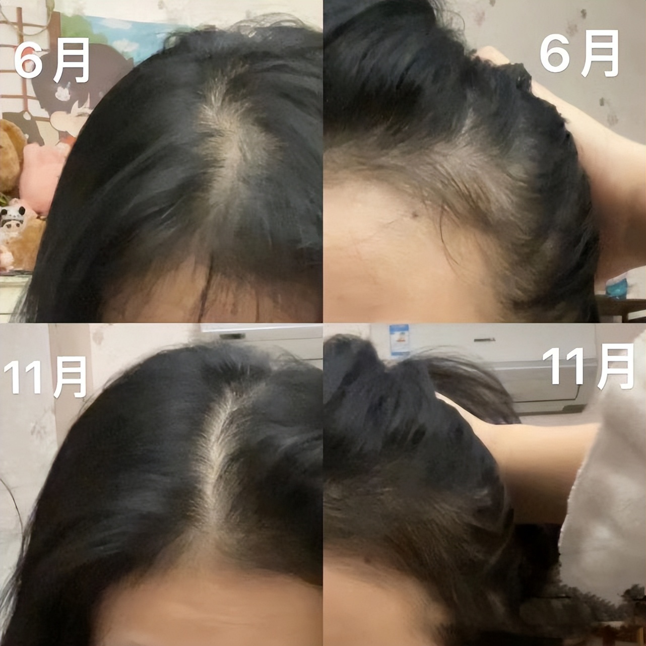 最受欢迎的洗发水生发,最受欢迎的控油洗发水品牌