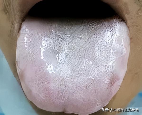 胃病引起的腹泻吃什么药管用,老中医治腹泻最快的方法