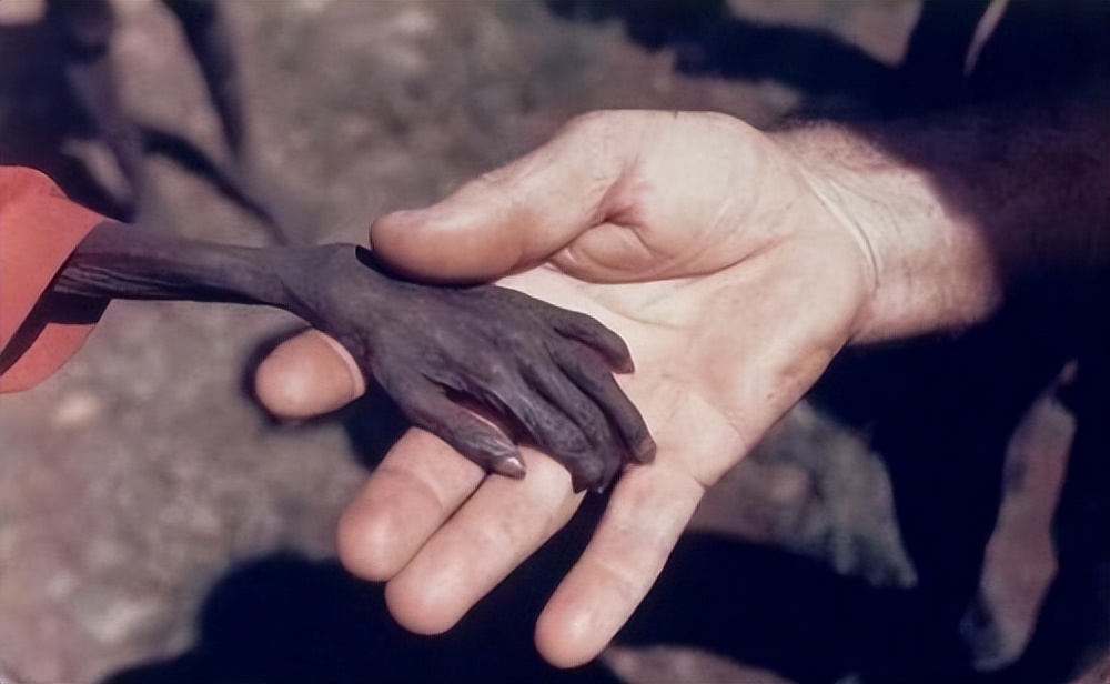 2013年，非洲2岁“巫童”遭父母遗弃，饿得皮包骨，如今还活着吗