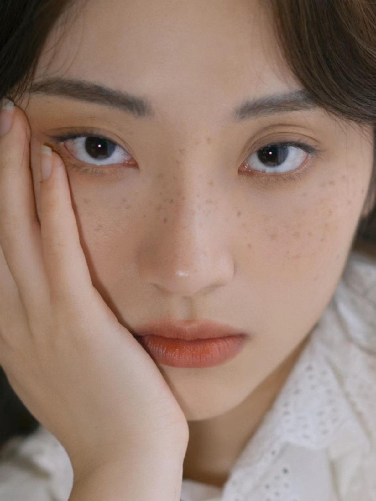 年轻长老年斑的原因以及解决方案,年纪轻轻就开始长老年斑怎么办