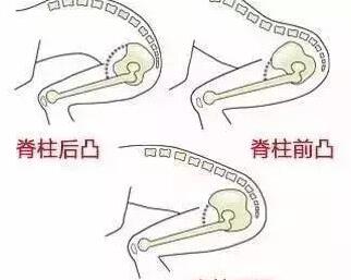冬天骑车怎么保护膝盖,骑车前怎么保护膝盖