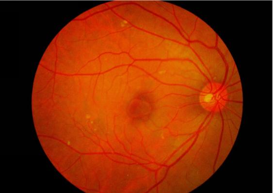 中科院杨佳现状,中科院教授杨佳近况