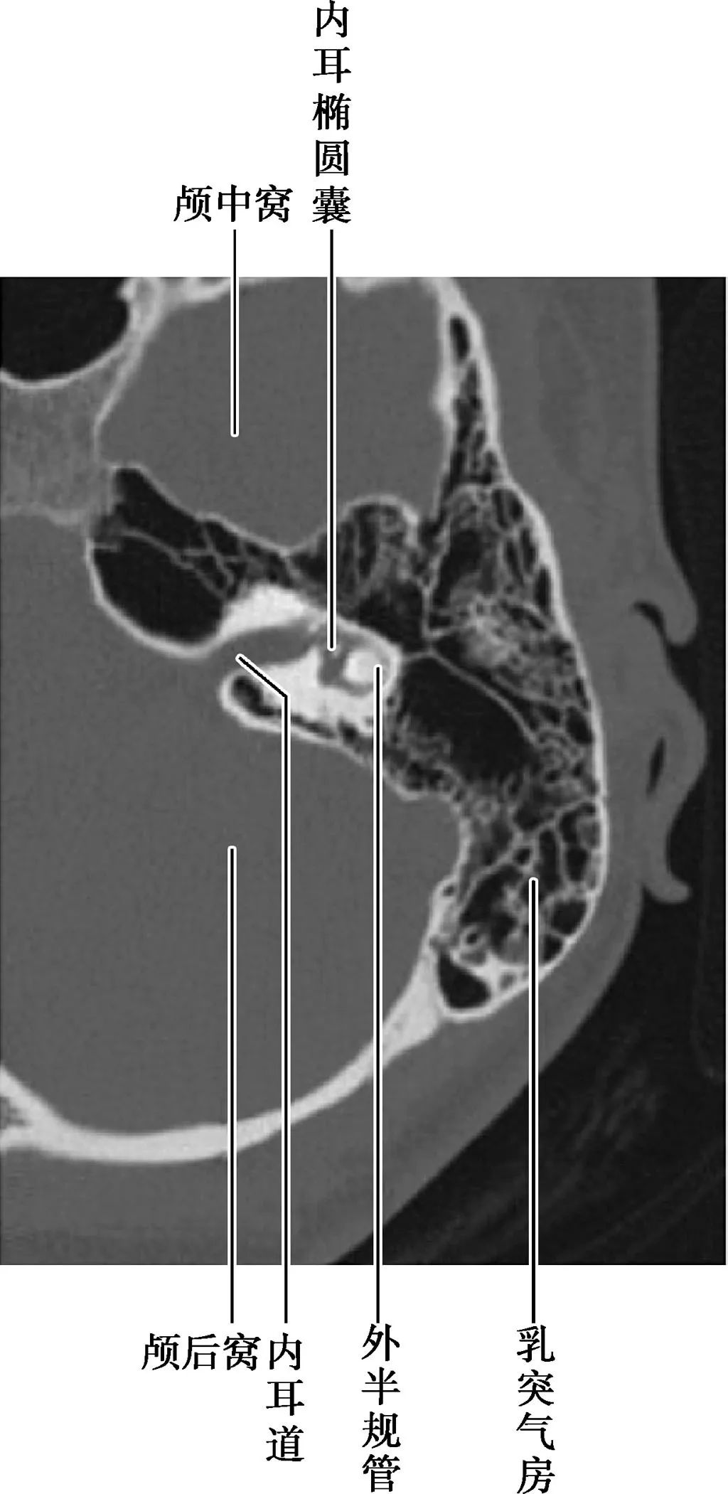 耳部解剖结构和生理功能,耳部解剖笔记