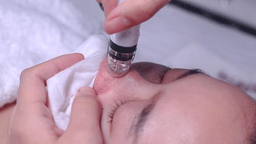 深层清洁毛孔污垢美容院,美容院清洁毛孔推荐品牌