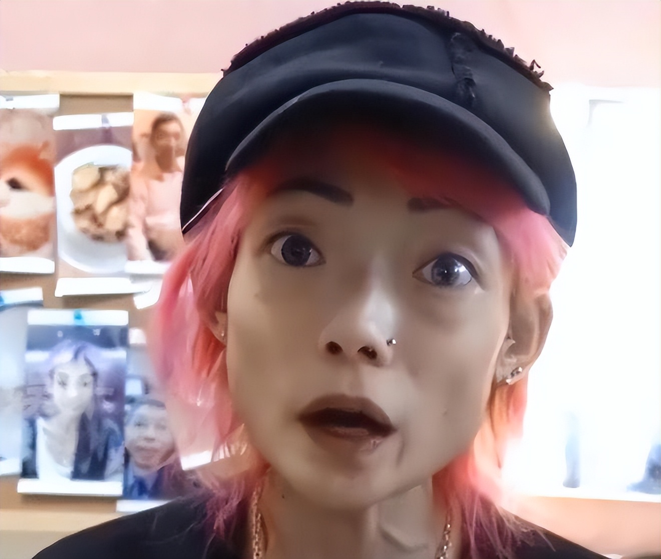 “最惨阔太”伍智恒：嫁豪门8年，换来牙齿全脱，体重仅剩44斤