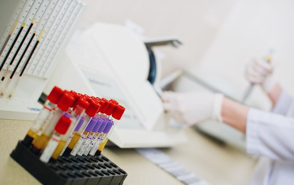 中老年人体检应该检查哪些项目,中老年人一年体检都检查什么