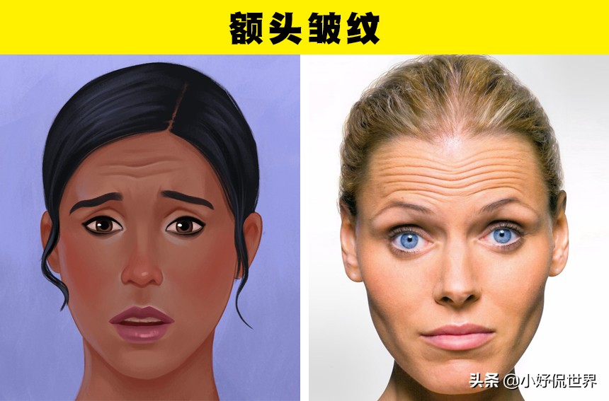 脸上有3种皱纹可能是健康的预警,皱纹跟情绪有关系吗