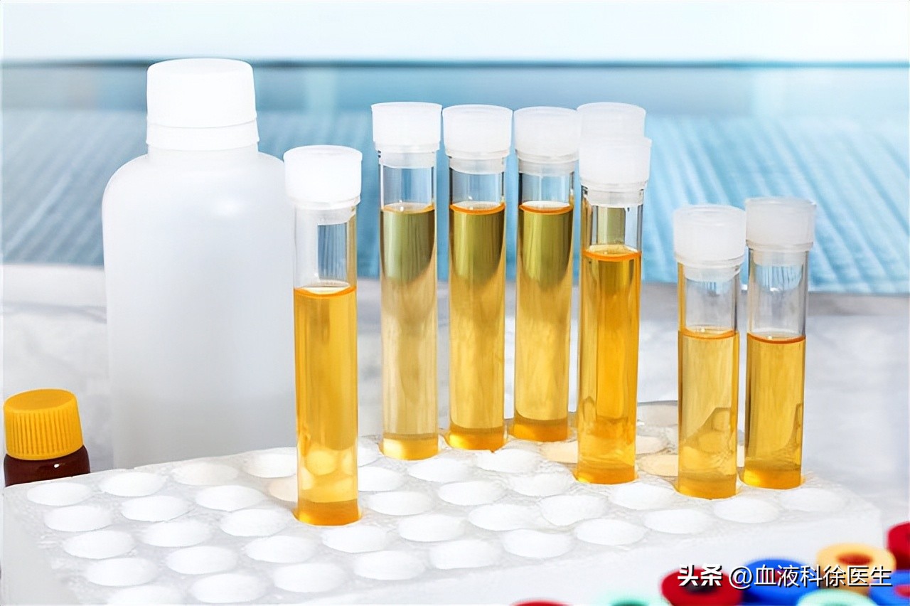 体检出肾结石怎么去医院问诊,体检检查出肾结石怎么处理