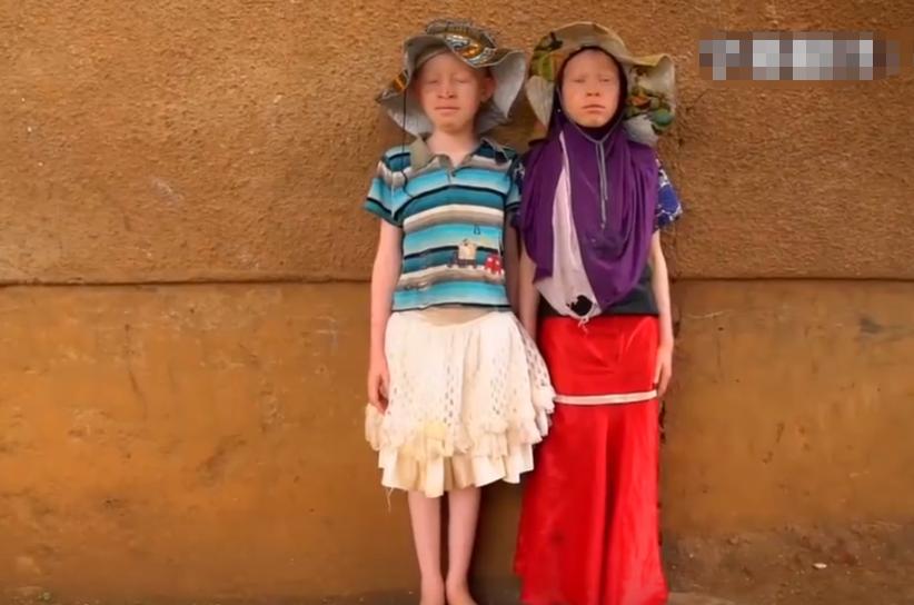 非洲医疗有多恐怖？小伙患上前列腺，医生竟用锤子砸胸口祛除病魔